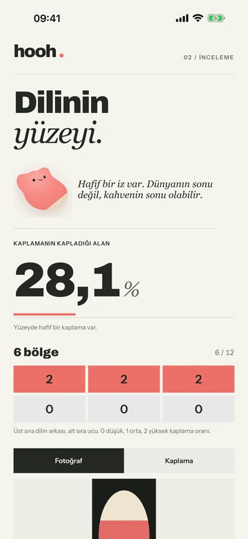 hooh: Dil yüzeyi değerlendirmesi ekranı